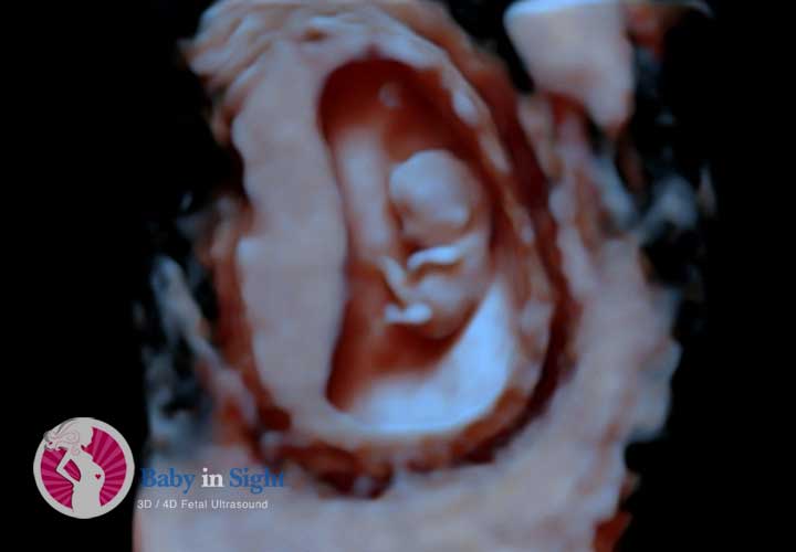 HD Live 5D Fetal Ultrasounds