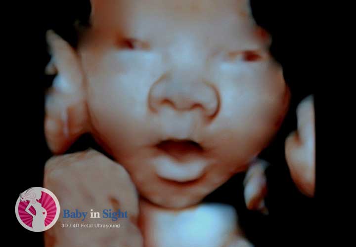 High Definition Live Fetal Ultrasounds
