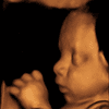 Fetal Postion Scan